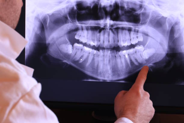 Best Emergency Wisdom Tooth Extraction in Walnut Ridge, AR
