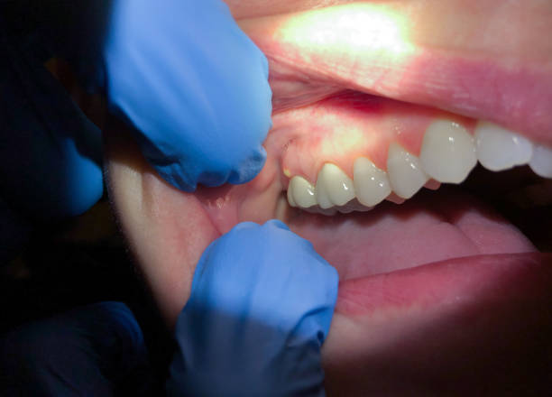 Professional Emergency Dental Service in AR