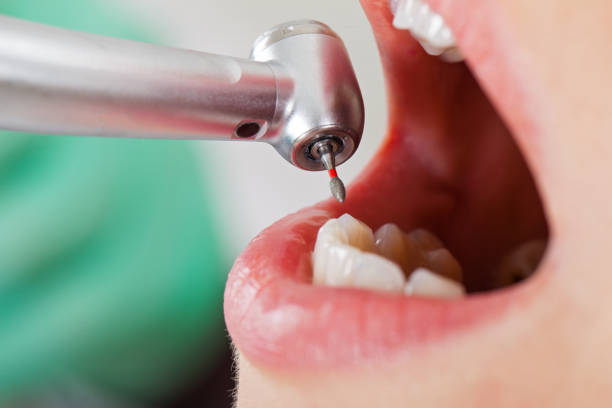 Reliable AR Emergency Dental Service Solutions